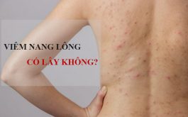 Viêm nang lông có lây không