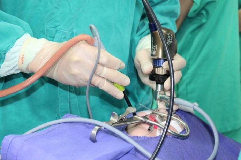 Coblator là phương pháp cắt amidan được nhiều bệnh viện áp dụng rộng rãi
