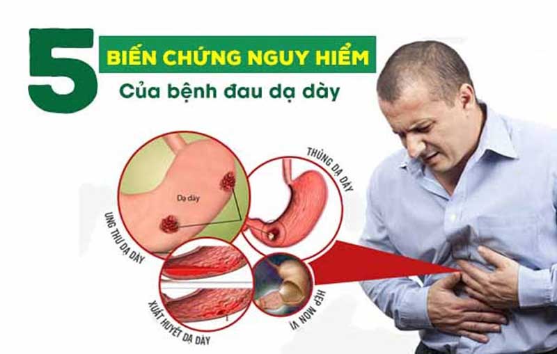 Đau dạ dày buổi đêm ảnh hưởng tới sức khỏe và chất lượng cuộc sống