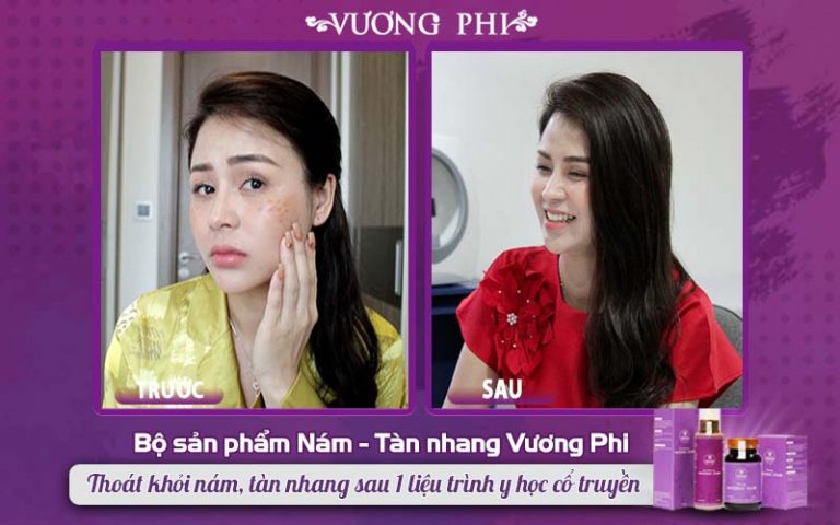 Hình ảnh khác biệt của diễn viên Lương Thu Trang trước và sau khi sử dụng Vương Phi