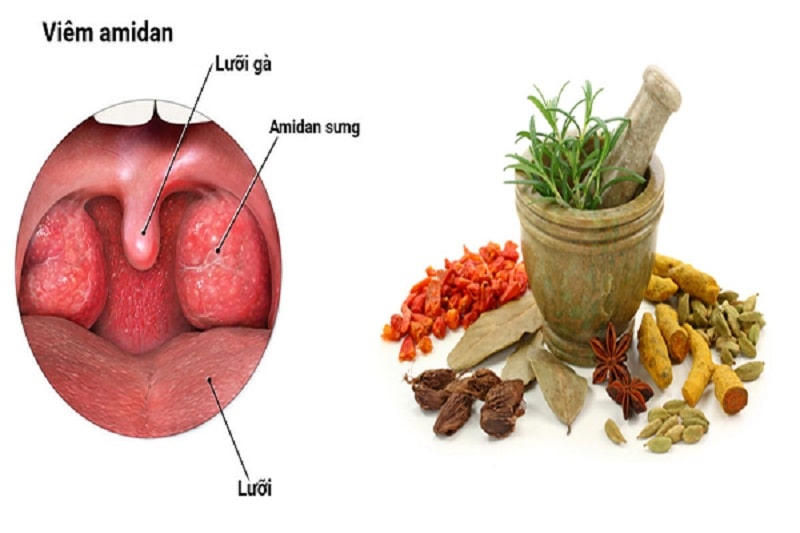 Thuốc đông y trị amidan