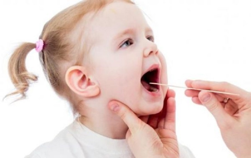 Viêm amidan ở trẻ là một trong những bệnh lý về hô hấp khá phổ biến