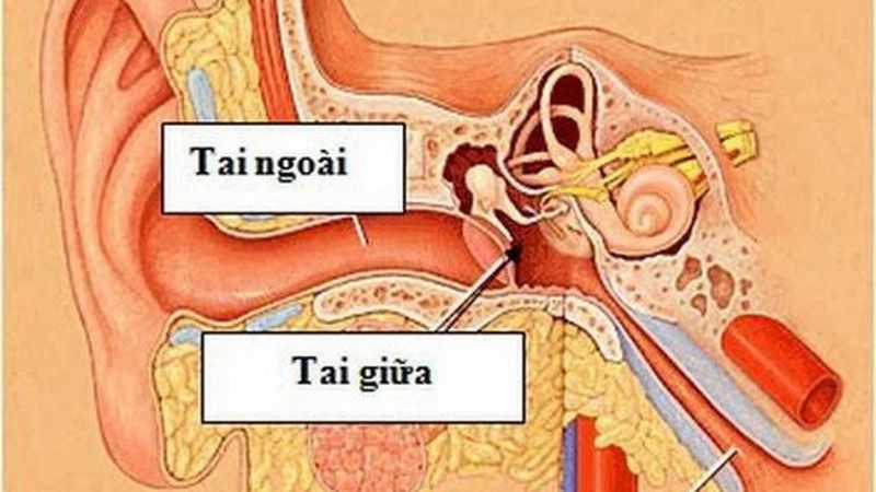 Bệnh về tai giữa được phân chia làm 2 giai đoạn
