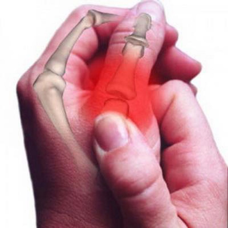 Nếu bẻ khớp không đúng cách có thể gây viêm khớp hoặc hao mòn xương khá nguy hiểm
