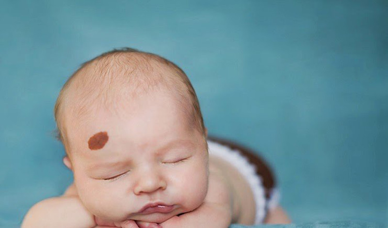 Vùng da bị chàm của bé cần tránh tiếp xúc với hóa chất, sữa tắm có tính tẩy rửa cao