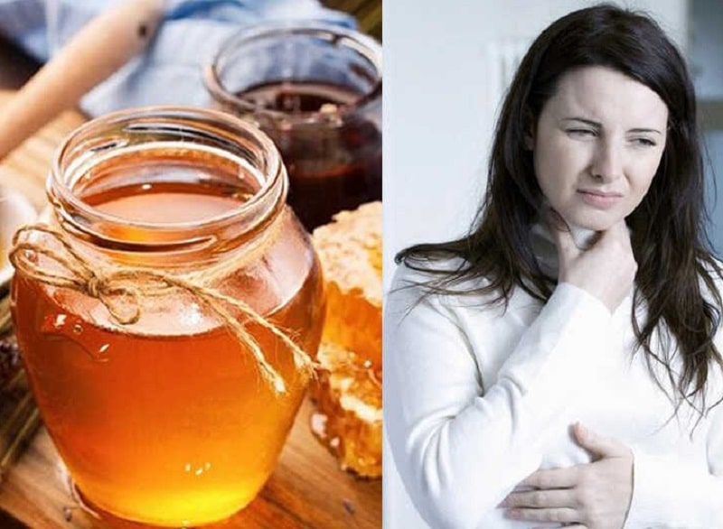 Chữa viêm amidan bằng mật ong được khá nhiều người áp dụng 