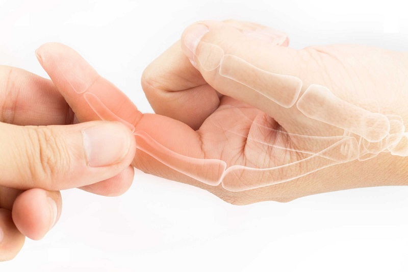 Cứng khớp ngón tay là một dấu hiệu của bệnh lý về xương khớp
