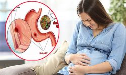 Thuốc đau dạ dày cho phụ nữ mang thai
