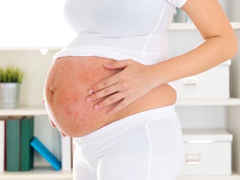 Có nhiều nguyên nhân bị nổi mẩn ngứa khi mang thai