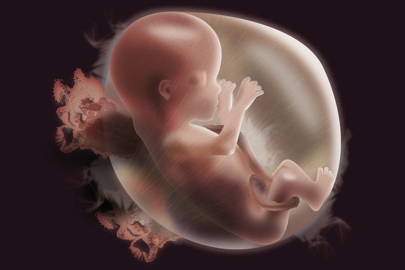 Phá thai được thực hiện khi phụ nữ mang thai ngoài ý muốn hoặc thai nhi phát triển không bình thường