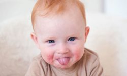 Trẻ bị nổi xung quanh miệng cũng có thể là triệu chứng của bệnh lở miệng