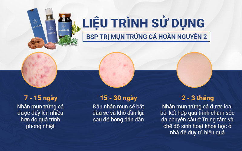 Liệu trình điều trị của Bộ sản phẩm Trị mụn trứng cá Hoàn Nguyên