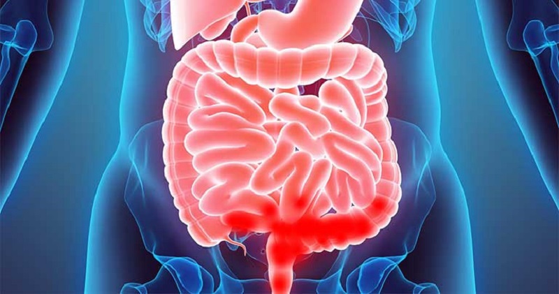 Xuất huyết tiêu hóa dưới có tên khoa học là Lower gastrointestinal bleeding