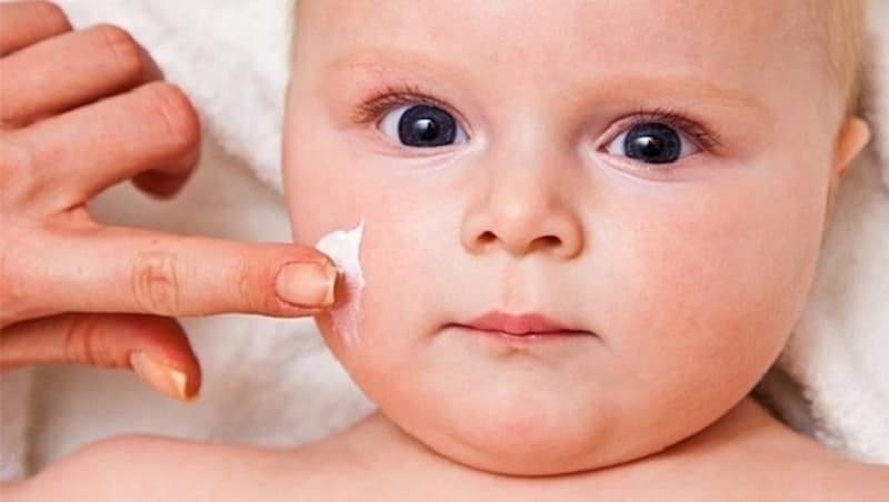 Hắc lào ở trẻ sơ sinh có thể điều trị bằng các loại thuốc bôi ngoài da