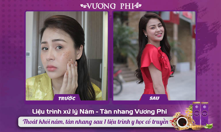 Diễn viên Lương Thu Trang và làn da sạch nám sau khi sử dụng Vương Phi