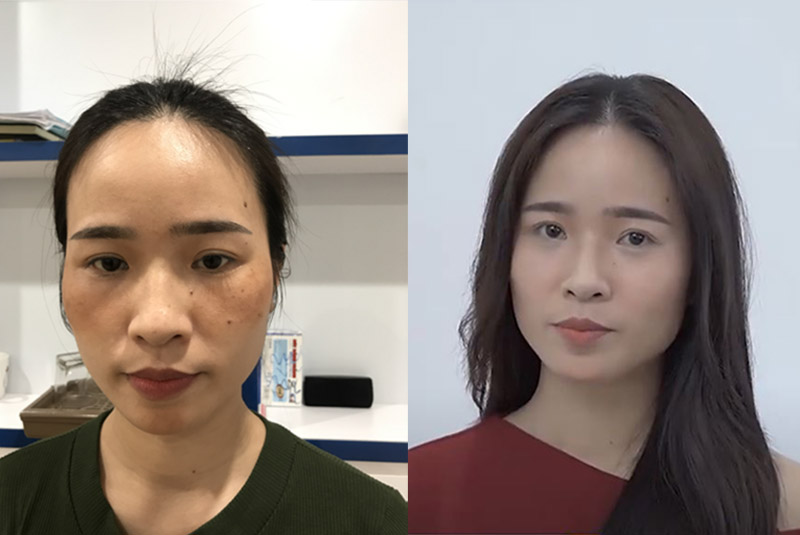 Hình ảnh trước và sau khi dùng Vương Phi của chị Thanh Thảo